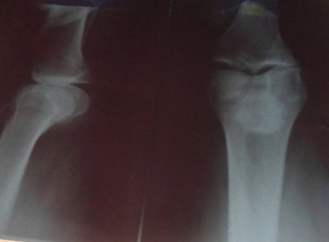 Una vecina vive una desesperante situación en torno a su salud y necesita ayuda