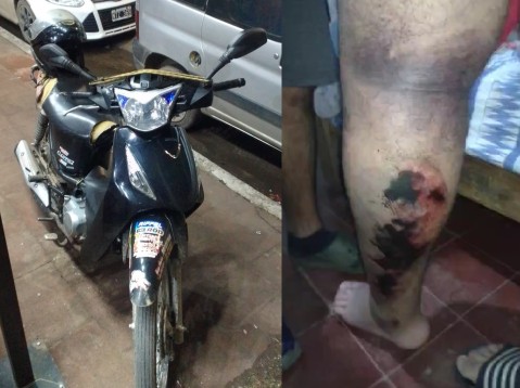 "Estoy vivo de milagro": joven delivery busca filmaciones del choque que sufrió en Ruta 7