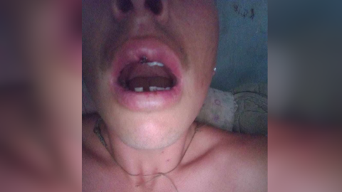 Golpearon y desfiguraron a un joven rodriguense en el boliche Kalahari de Luján: "Casi me quita la vida"