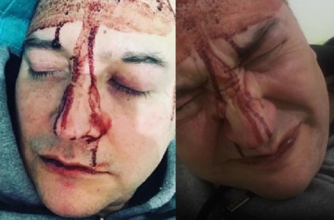 Video: el cantante Leo García denunció un brutal ataque homofóbico en Gral Rodríguez