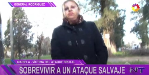 Una mujer sufrió un salvaje ataque de un hombre cuando iba a trabajar