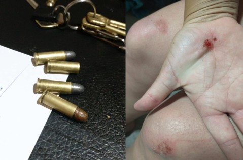 Raspones y balas en el asfalto: el asalto de motochorros que sufrió una joven en el centro