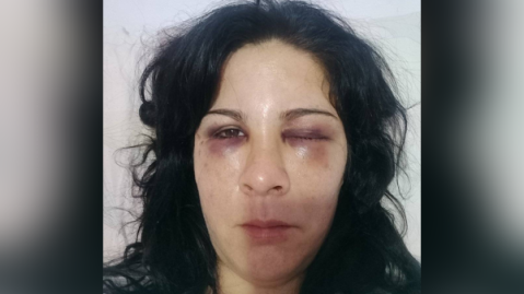 Otra rodriguense cuenta la paliza que había recibido en Luján, pero antes de los incidentes