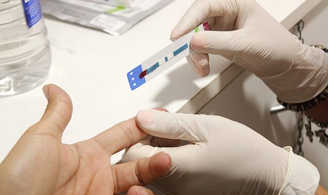 VIH y sífilis: cuáles son los centros donde los rodriguenses pueden hacerse el testeo de forma gratuita