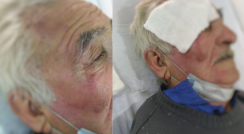 Buscan testigos para esclarecer un grave siniestro vial que le cambió la vida a un hombre de 83 años