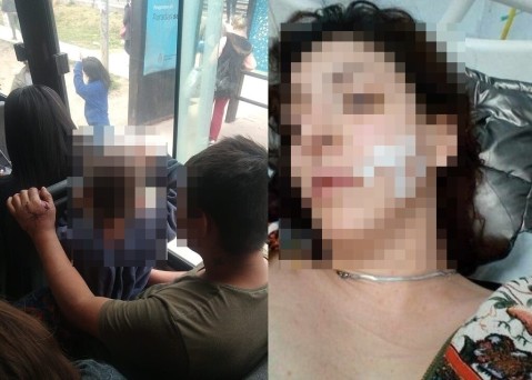 El sangriento episodio de violencia de género detrás de una llamativa foto tomada en un colectivo