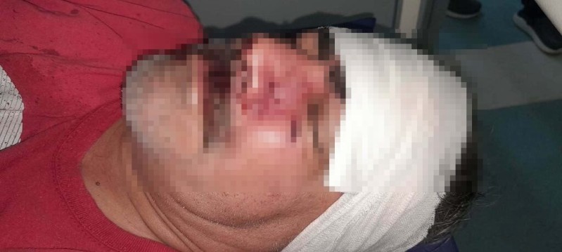 Un conflicto por la basura terminó con un vecino hospitalizado en el Vicente López