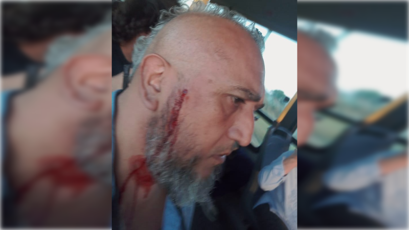 C&oacute;mo sigue el chofer de La Perlita herido de bala en la Ruta 24