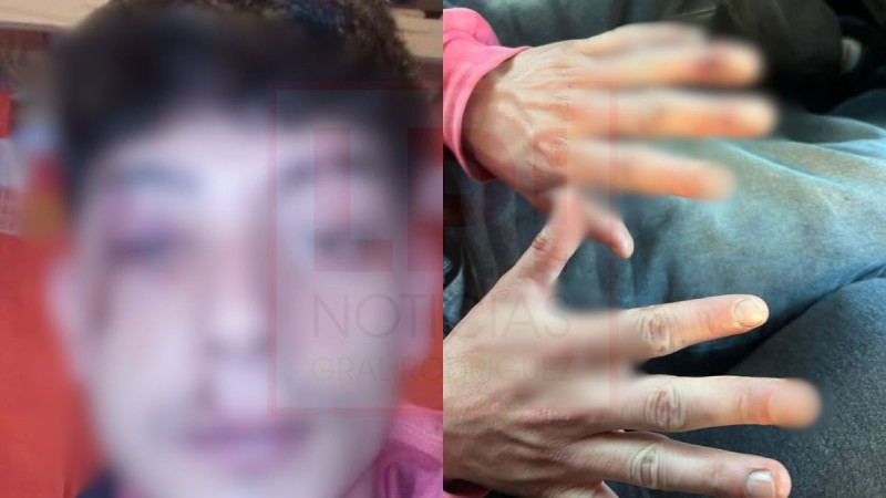 Joven fue brutalmente golpeado y asaltado a la salida de un bar c&eacute;ntrico