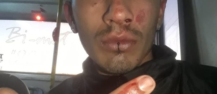 joven-golpeado-en-moreno
